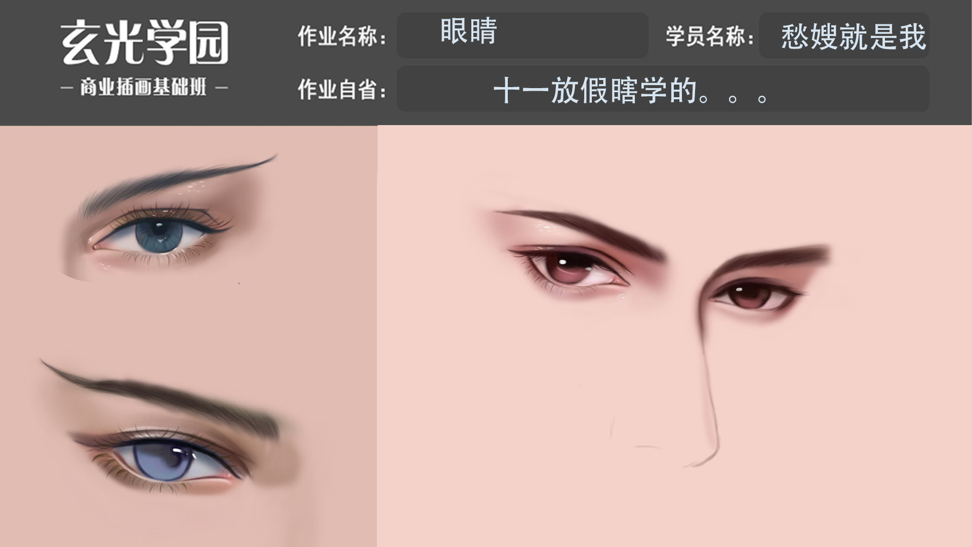 眼睛作业3.png